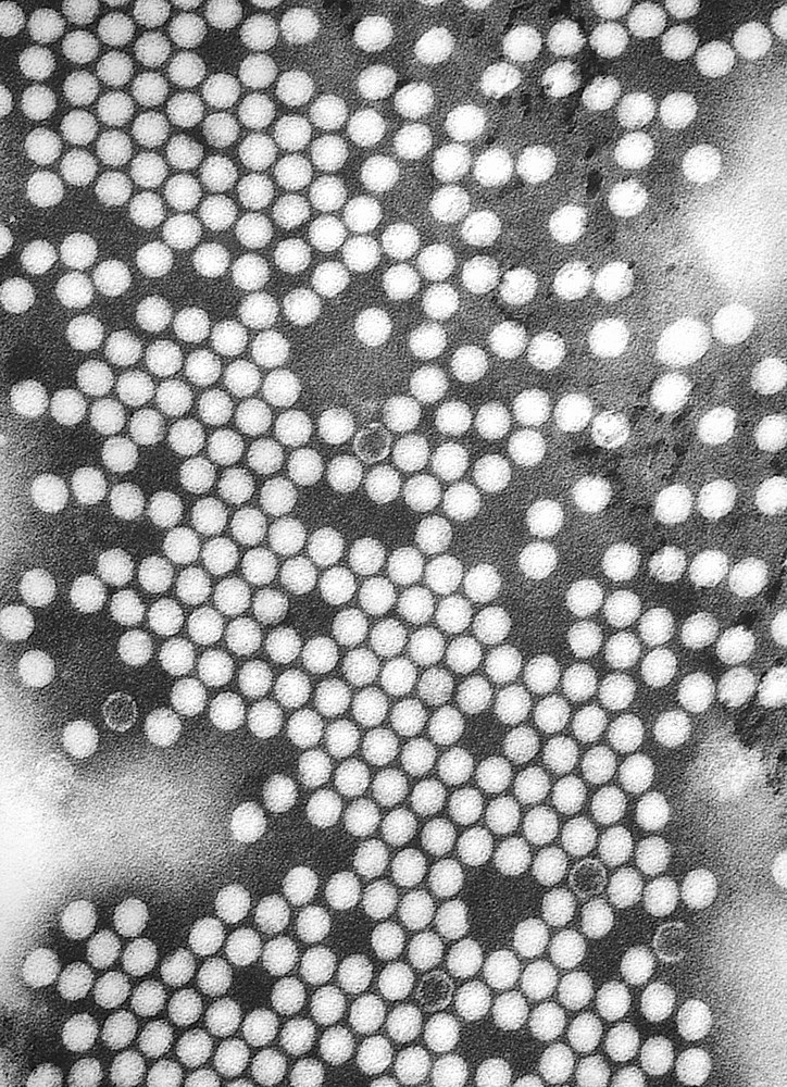 Polio virus image